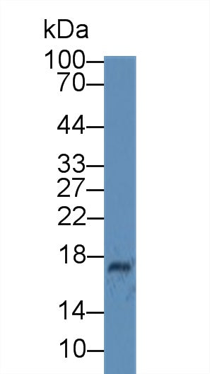 Monoclonal Antibody to Ceruloplasmin (CP)