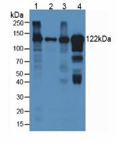 Monoclonal Antibody to Ceruloplasmin (CP)