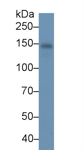 Monoclonal Antibody to Retinol Binding Protein 4 (RBP4)