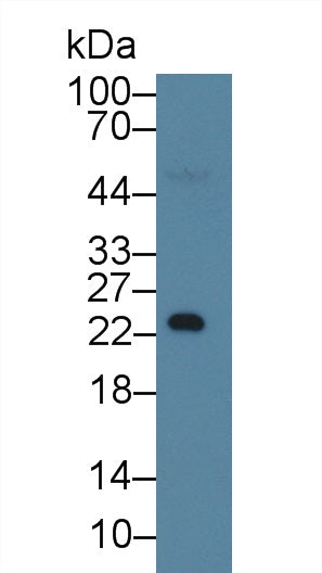 Monoclonal Antibody to Nephrin (NPHN)