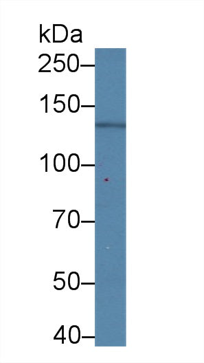 Monoclonal Antibody to Procollagen I N-Terminal Propeptide (PINP)