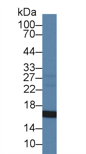 Monoclonal Antibody to Endoglin (ENG)