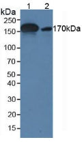 Monoclonal Antibody to Alpha-2-Macroglobulin (a2M)