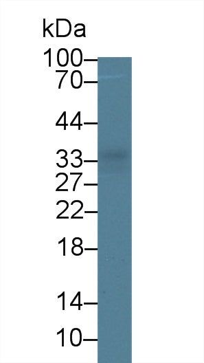 Monoclonal Antibody to Tryptase (TPS)