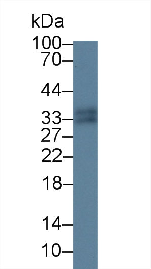 Monoclonal Antibody to S100 Calcium Binding Protein A12 (S100A12)