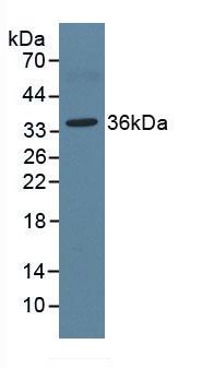 Monoclonal Antibody to Arginase (ARG)