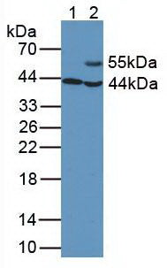 Monoclonal Antibody to Aspartate Aminotransferase (AST)