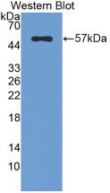 Monoclonal Antibody to Fibrinogen Beta Chain (FGB)
