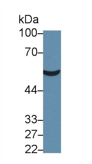 Monoclonal Antibody to Cytokeratin 18 (CK18)