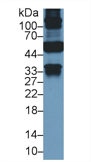 Monoclonal Antibody to Cytokeratin 19 (CK19)