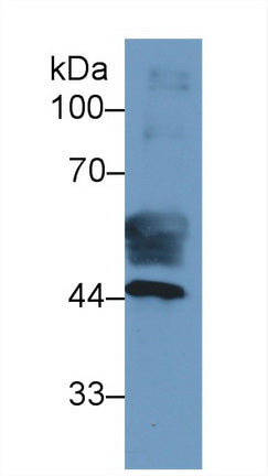 Monoclonal Antibody to Cytokeratin 19 (CK19)