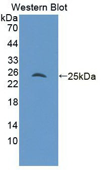 Monoclonal Antibody to Androgen Receptor (AR)