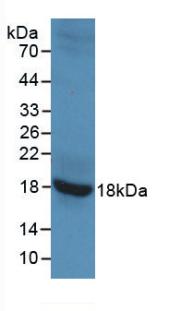 Monoclonal Antibody to Glutamate Decarboxylase 2 (GAD2)