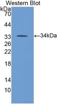 Monoclonal Antibody to 5-Lipoxygenase (5-LO)