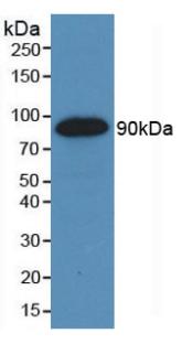Monoclonal Antibody to Vascular Endothelial Growth Factor Receptor 2 (VEGFR2)