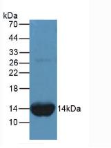 Monoclonal Antibody to Fatty Acid Binding Protein 1 (FABP1)