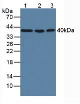 Monoclonal Antibody to Major Basic Protein (MBP)