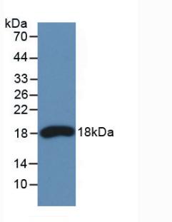 Monoclonal Antibody to Ribonuclease A3 (RNASE3)