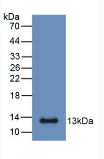 Monoclonal Antibody to S100 Calcium Binding Protein A6 (S100A6)
