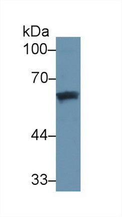 Monoclonal Antibody to Vitamin D Binding Protein (DBP)