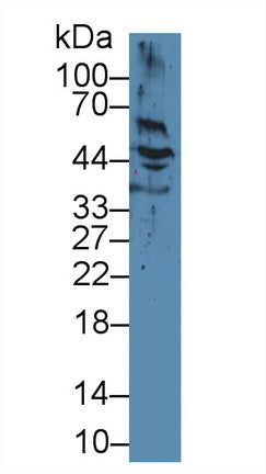 Monoclonal Antibody to Cytokeratin 17 (CK17)
