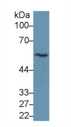 Monoclonal Antibody to Tubulin Beta (TUBb)