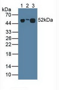 Monoclonal Antibody to Leucine Rich Alpha-2-Glycoprotein 1 (LRG1)