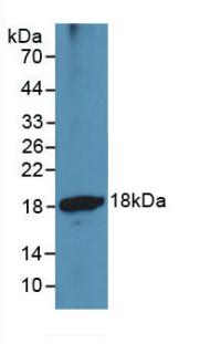 Monoclonal Antibody to A Disintegrin And Metalloproteinase With Thrombospondin 1 (ADAMTS1)