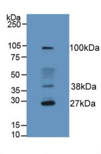 Monoclonal Antibody to Hemojuvelin (HJV)