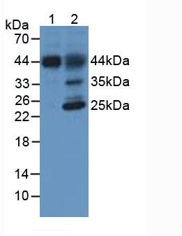 Monoclonal Antibody to Hemojuvelin (HJV)