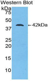 Monoclonal Antibody to Creatine Kinase B (CK-BB)