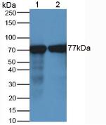 Monoclonal Antibody to Transferrin (TF)