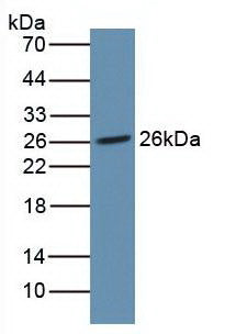 Monoclonal Antibody to Noggin (NOG)