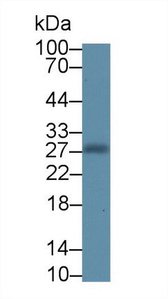 Monoclonal Antibody to Noggin (NOG)