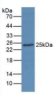 Monoclonal Antibody to Anterior Gradient 2 (AGR2)