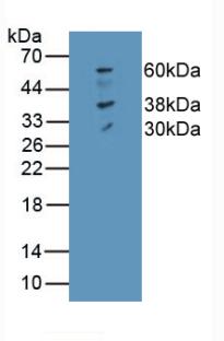 Monoclonal Antibody to Ferroportin (FPN)
