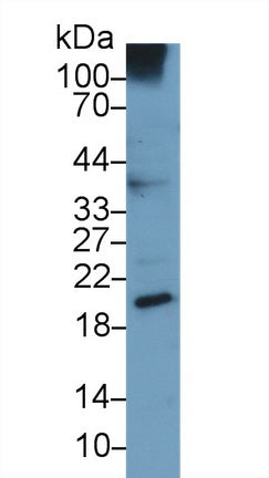 Monoclonal Antibody to Urocortin 3 (UCN3)