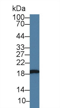 Monoclonal Antibody to Heat Shock Protein Beta 6 (HSPb6)