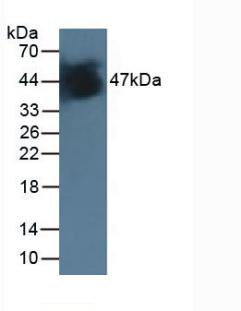 Monoclonal Antibody to Isocitrate Dehydrogenase 1, Soluble (IDH1)