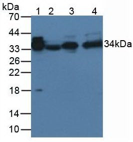 Monoclonal Antibody to Alpha-2-Glycoprotein 1, Zinc Binding (aZGP1)