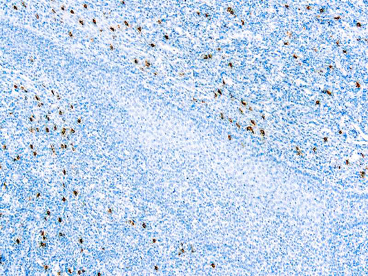 Mast Cell Tryptase
