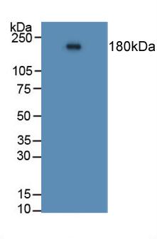 Polyclonal Antibody to Angiotensin I Converting Enzyme (ACE)