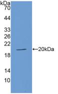 Polyclonal Antibody to Angiotensin I Converting Enzyme (ACE)