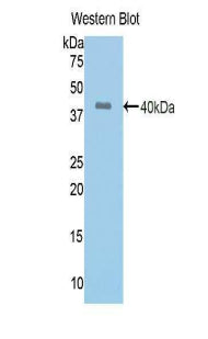 Polyclonal Antibody to Angiotensin I Converting Enzyme (ACE)