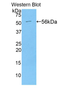 Polyclonal Antibody to Angiotensin I Converting Enzyme (ACE)