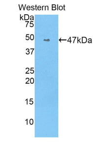 Polyclonal Antibody to Angiotensin I Converting Enzyme (ACE)