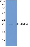 Polyclonal Antibody to Angiopoietin 1 (ANGPT1)