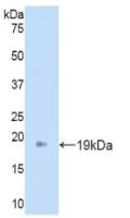 Polyclonal Antibody to Angiopoietin 2 (ANGPT2)