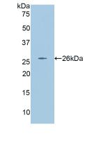 Polyclonal Antibody to Angiopoietin 2 (ANGPT2)