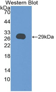 Polyclonal Antibody to Connective Tissue Growth Factor (CTGF)